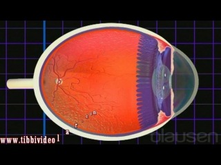 what is astigmatism?